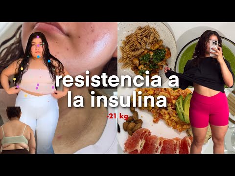 revertí mi resistencia a la insulina · mi experiencia | -21 kg