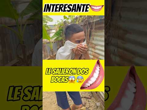 Le salieron dos bocas 👄😱interesante asombroso 😱😰