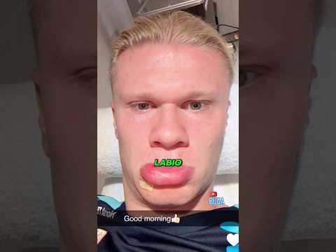 Haaland volvió a destrozar el fútbol 🤯⚡️