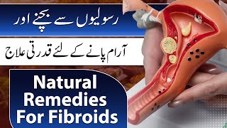 Natural Remedies for Fibroids | Pakistan Life