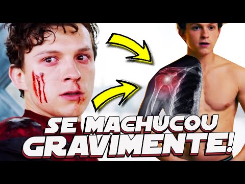 10 ATORES QUE SE MACHUCARAM GRAVEMENTE NOS FILMES
