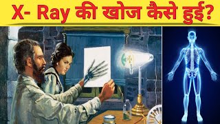 X- Ray की खोज कैसे हुई ? | History of X Ray Technology