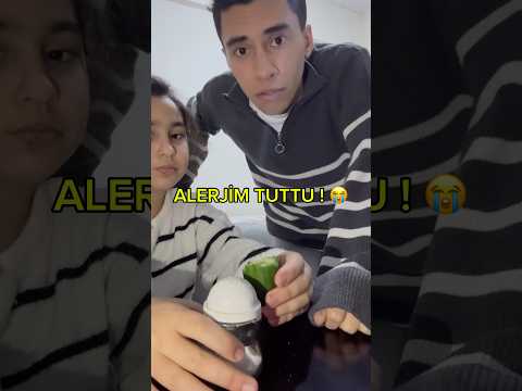 ALERJİM TUTTU !