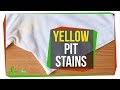 Understanding Sweat and Clothing Stains