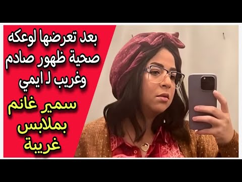 بعد تعرضها لوعكه صحية ظهور صادم وغريب لـ ايمي سمير غانم بملابس غريبة