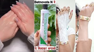 रात में सोने से पहले Ponds Cream में ये मिलाकर लगालो, काले हाथ-पैर गोरे मुलायम और सुंदर हो जाएंगे