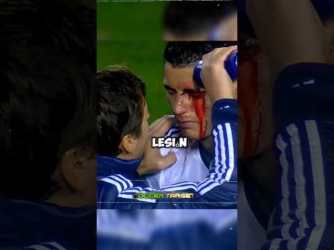 Cristiano Ronaldo casi resultó herido por esta lesión 😭❤️‍🩹