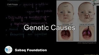 Genetic Causes