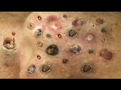 Most Satisfying and Relaxation with An Spa Video #2121