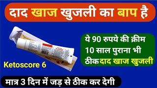 दाद खाज खुजली का परमानेन्ट इलाज 2 दिन लगाना है बस | Best Cream For Ringworm And Scabies 