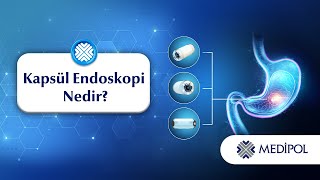 Kapsül Endoskopi Nedir?