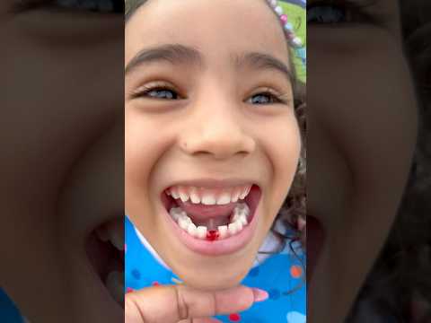 Manu arrancou o primeiro dentinho #shorts