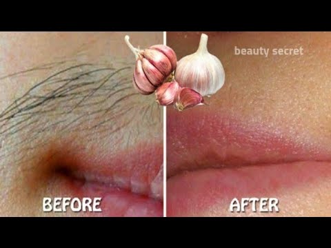 Stop shaving! Here's how to get rid permanently facial, body and pubic hair.