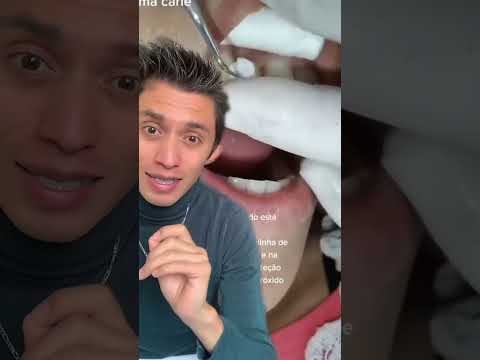 Exige esto a tu dentista aislamiento dental