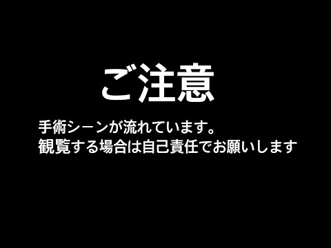 結婚式3日後に手術しました