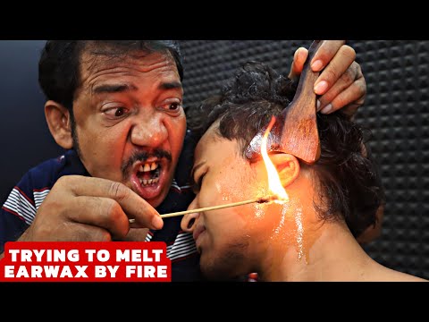 Asim Barber Trying to Melt Earwax by Fire | Fire Hair Removal | Head Massage & Neck Cracking | ASMR
