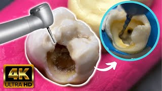 Extreme dental restoration!