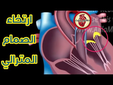 ارتخاء الصمام المترالي (المضاعفات والعلاج)