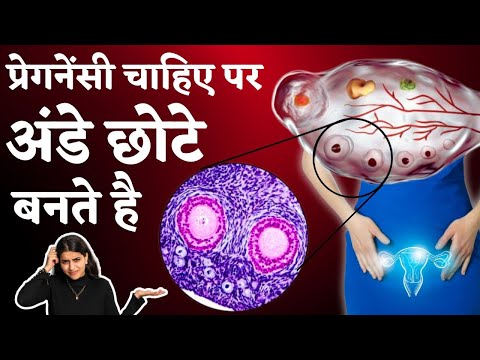 प्रेगनेंसी चाहिए पर अंडे छोटे बनते है - Egg size & quality tips, fertility tips #prernafertilitycare