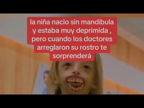 la niña nacio sin mandíbula y estaba muy deprimida, pero cuando los doctores arreglaron su rostro te