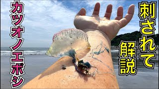 【実演】カツオノエボシに刺されるとこうなります