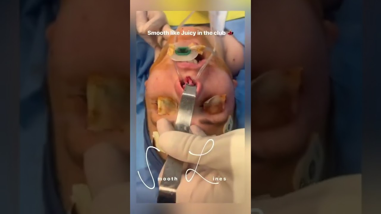 Surgical procedure in a medical environment.