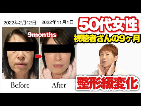【ほうれい線・ブルドッグ顔】視聴者さんが9ヶ月で変化した方法!