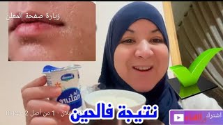 وجهك ناشف وحرش طبقي هاد الكوماج غير ب2مكونات ونتيجة فالحين🥰🤩