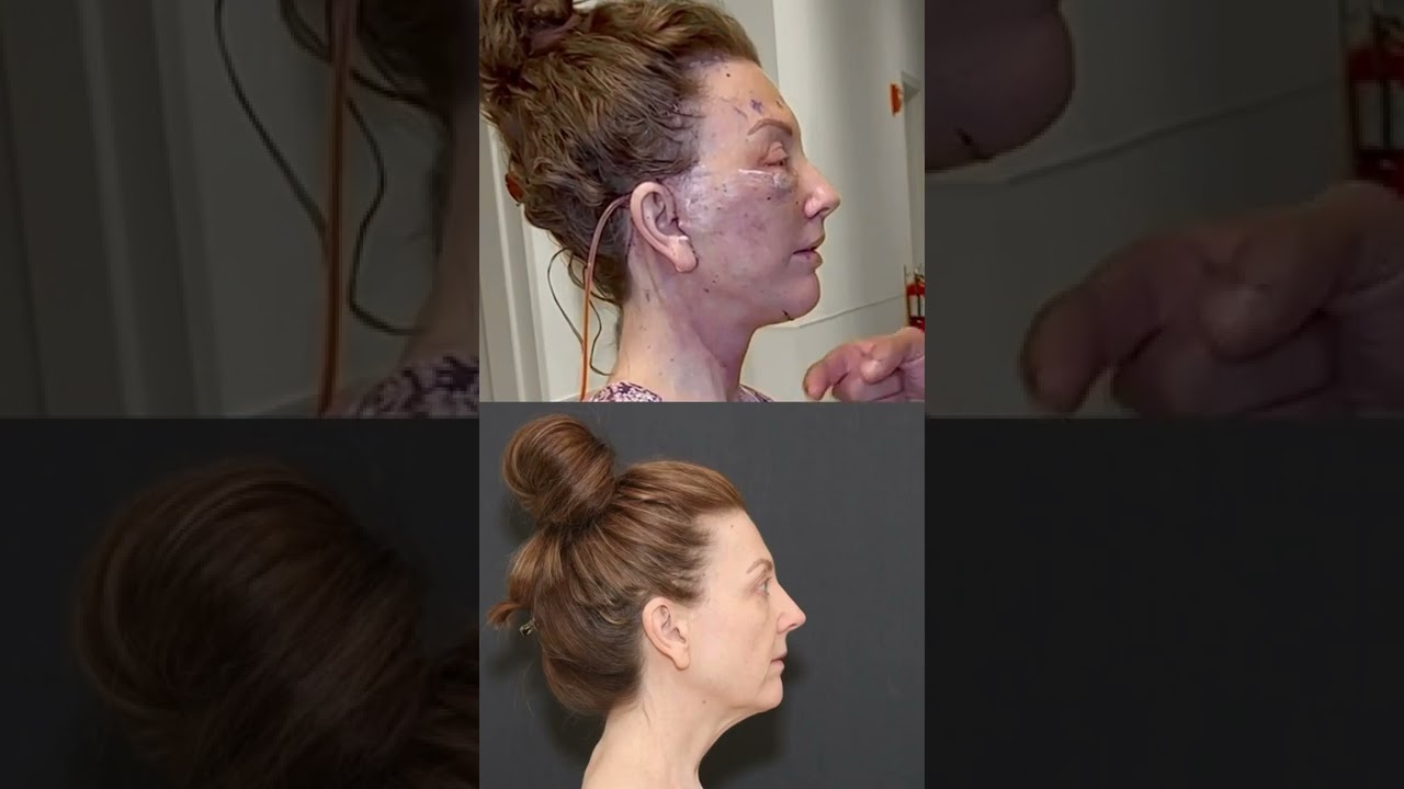 Side-by-side of two different hairstyles.