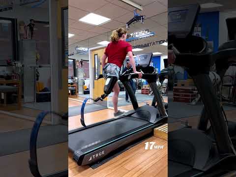 Tina a AKA Sprinting with Running Blade Prosthesis