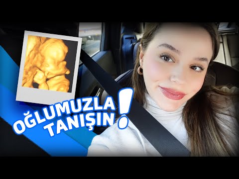 OĞLUMUZLA TANIŞIN 21+4 Detaylı Ultrason Vlog 🥹💕