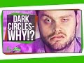 Understanding Dark Circles and Their Causes