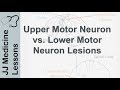 Upper and Lower Motor Neuron Lesions