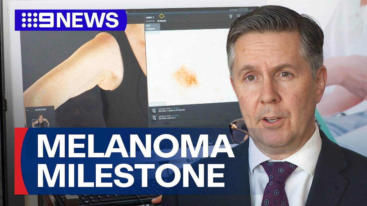 Skin cancer screening research receives  million boost |