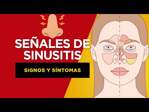 12 SEÑALES DE QUE PODRÍAS TENER SINUSITIS!