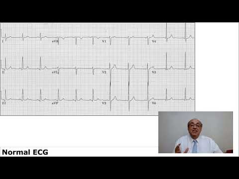 EKG Trainer (Case 40) Answer