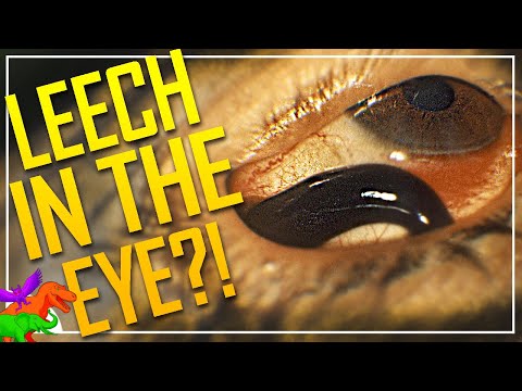 There Are Leeches That Live In Your EYE?!!??!