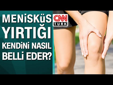 Menisküs yırtığı kendini nasıl belli eder?