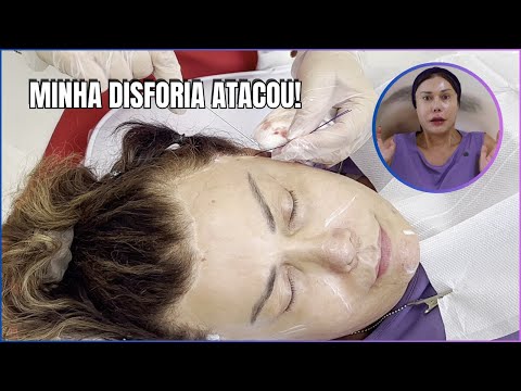 💉🔥O QUÊ EU FIZ COM MEU ROSTO !? TRANSFORMAÇÃO CHOCANTE! 😱 | JOANNA MARIA