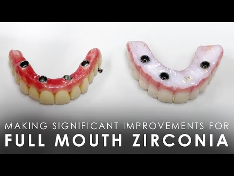 Making Significant Improvements for Full Mouth Zirconia