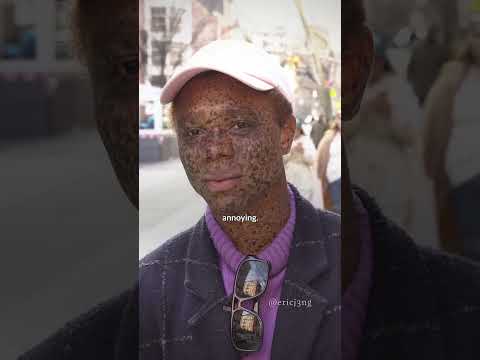 This is why it’s rude to stare at people