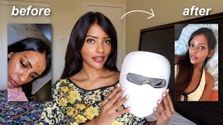 My Summer Skincare Routine ♡ Fix Hyperpigmentation |LED Mask & Red light Therapy Mask