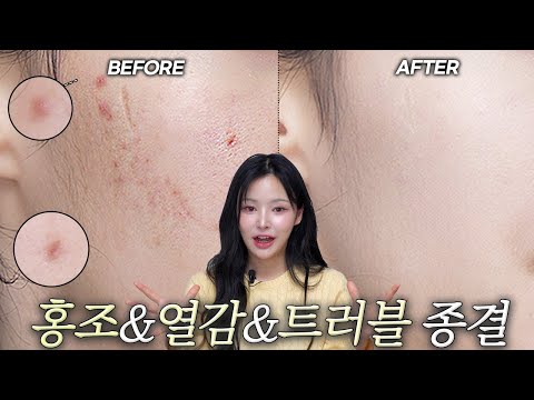 열감&트러블피부‼️커버 300% 쉽고 깔끔하게 하는법.zip| 컨실러활용법/열감내리기/트러블쪽집게강의