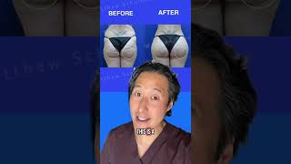 4 New Cosmetic Treatments to Know About!