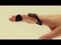 Kepner Orthosis Construction and Application