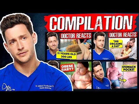 Doctor Mike Reacts To Rarest Diseases Compilation
