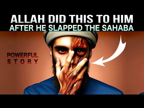 HE SLAPPED THE SAHABA, ALLAH DID THIS TO HIM