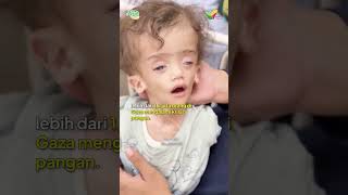 Hentaskan Lapar di Gaza Lewat Bantuan Kemanusiaan