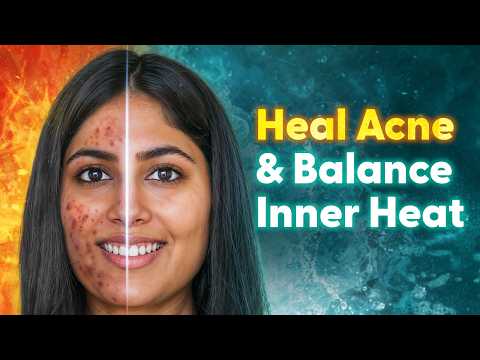 Ayurvedic Diet Plan to Heal Acne and Acidity