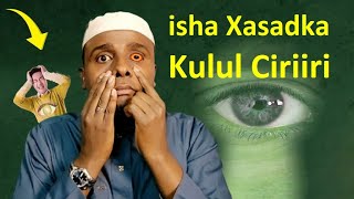 Halista isha xasadka jirkaada kujirta sunta ay wadato siday Qofka ka Dhigto